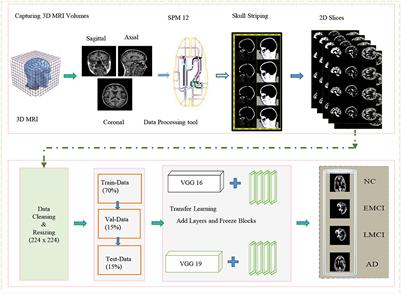 A transfer learning approach for multiclass classification of Alzheimer's disease using MRI images